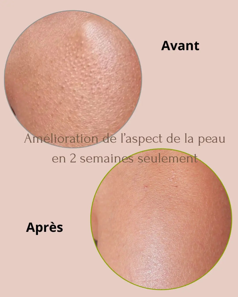 GANT EXFOLIANT ANTI-POILS INCARNÉS