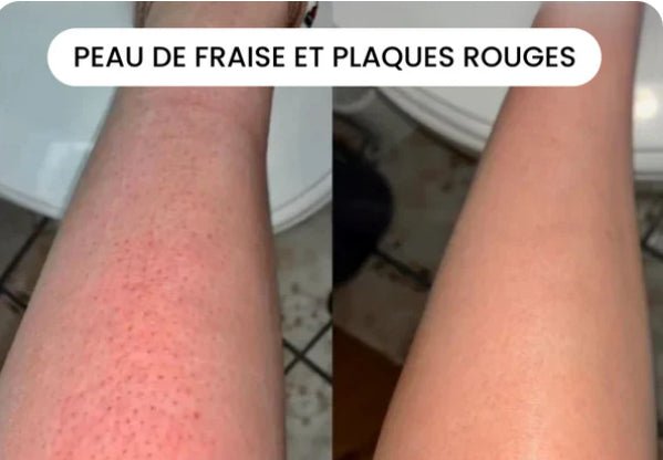 Kit Rasage & Soin Intime