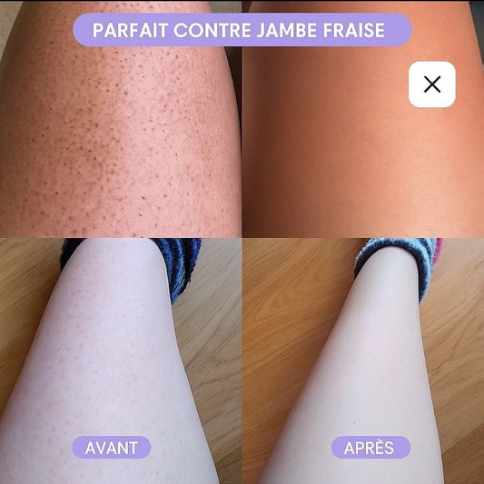 “Quel rasoir utiliser pour éviter les irritations et les poils incarnés ?