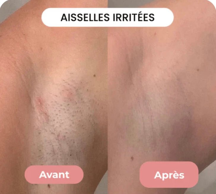 DUAL-HEAD PRO • RASOIR ÉLECTRIQUE KLYNE