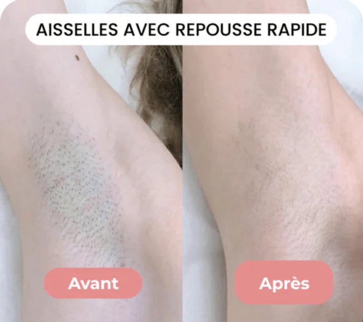 DUAL-HEAD PRO • RASOIR ÉLECTRIQUE KLYNE